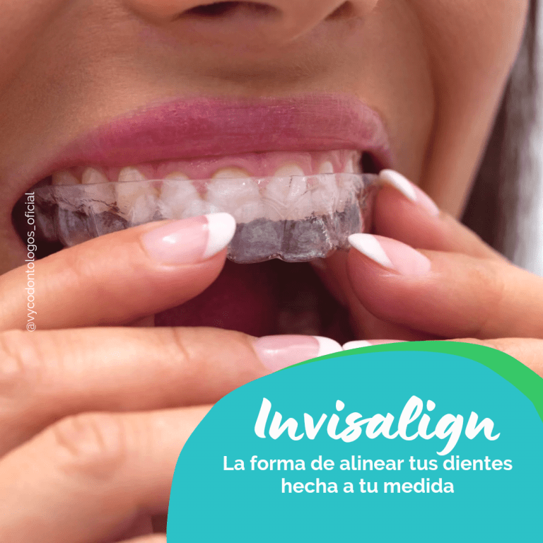 Ortodoncia invisible o brackets: ¿qué tratamiento elegir?