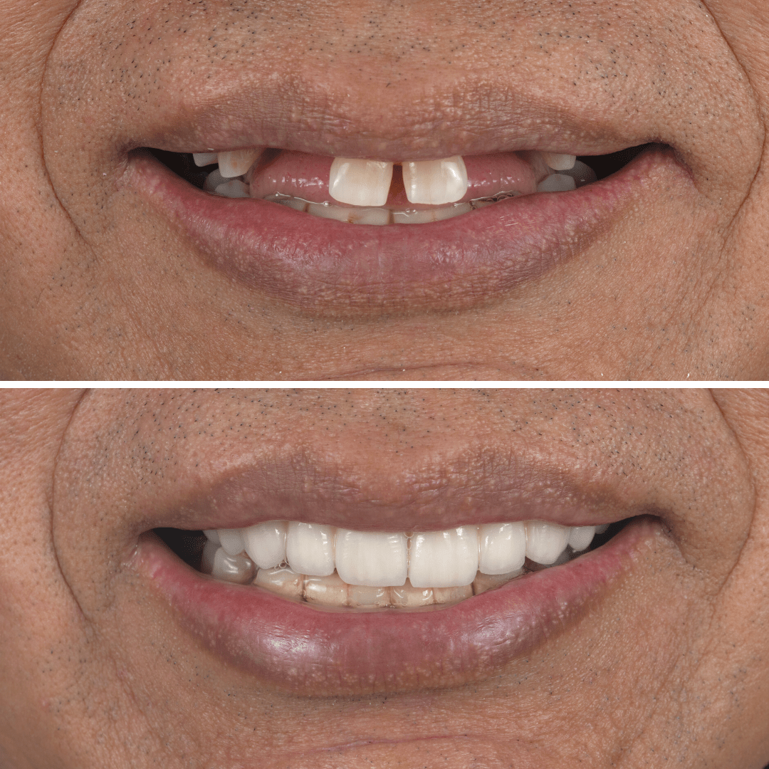 Rehabilitación oral en Lima